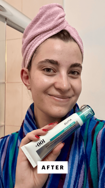 Felbin after applying the Anua PDRN Hyaluronic Acid 100 Moisturizing Cream